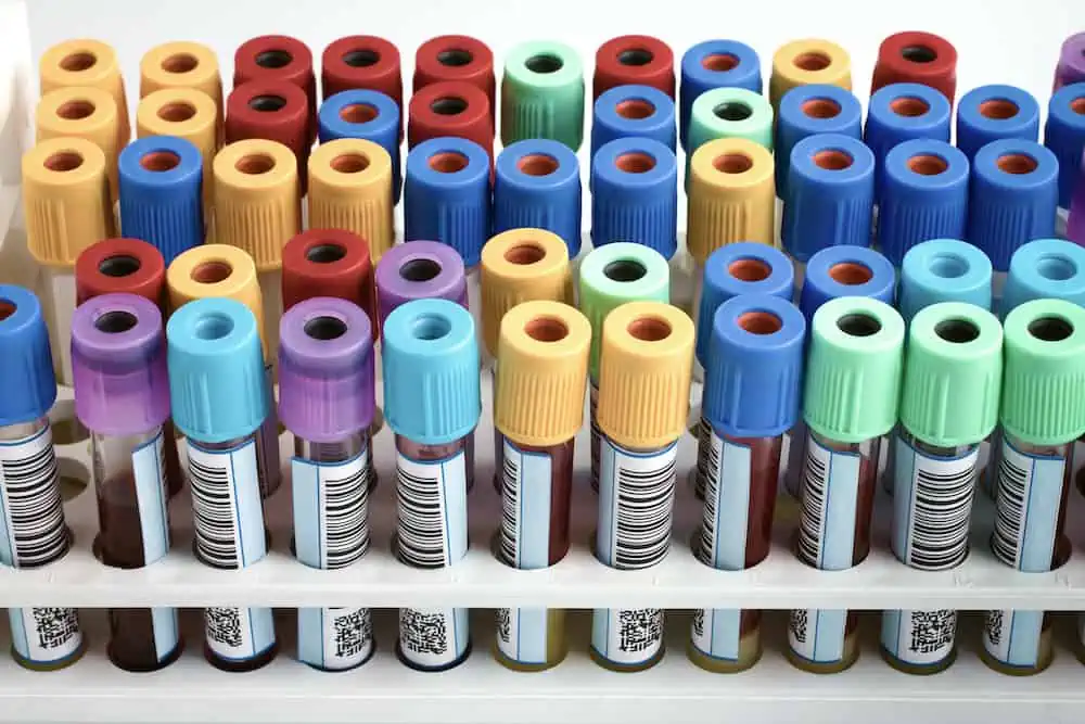 vials with different colored lids