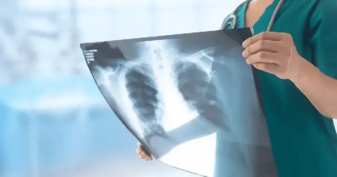 X-Rays and Injury Treatment at Get Well Urgent Care